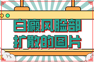 手臂皮肤上有白斑是什么原因(都做哪些病因检查)身上出现白块是什么原因
