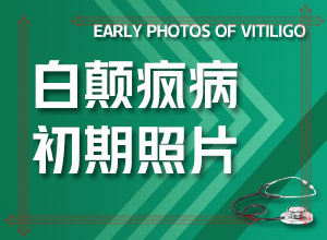 身上有白斑的原因图片用吃什么药-黑色素培植术不是什么原因-是什么原因引起
