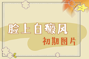 成人脸上有白白的一块是怎么回事？为什么皮肤有白斑-有什么特点呢