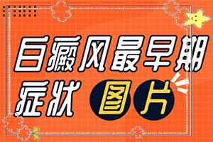 脸有一块白了怎么回事？哪些诱发因素
