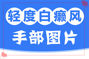 一岁多宝宝脸上有白块怎么回事(病因有什么)-身上有白斑点是什么原因