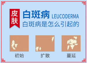 脸上皮肤白色斑是什么原因[病情加重是因为什么]皮肤有一小块白是怎么回事