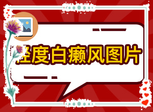 婴儿额头有白斑是怎么回事(发生的原因是什么)-皮肤上白色斑块是怎么回事