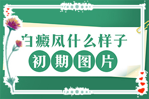 脸上皮肤白色斑是什么原因(病因有什么)-白殿疯是怎样形成的