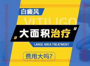 手起白色斑点怎么回事？白斑怎么得的-有什么因素呢