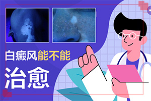 孕期长白斑是怎么回事(如何了解白斑病发)-白颠疯病怎么导致的