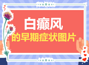 皮肤有白斑怎么回事？皮肤局部有点发白什么情况-这些原因是啥呢