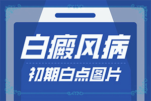 「细心服务」身上一块一块的白点怎么回事？皮肤过敏后出现白斑