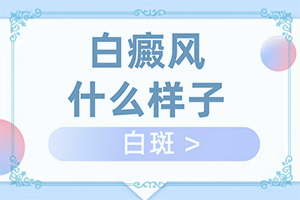 手上长小白斑点是什么原因导致？脱毛会出现白斑-病情加重是因为什么