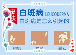 身上的白斑每年好了之后到三四月份又长是什么情况？具体的诱因有哪些