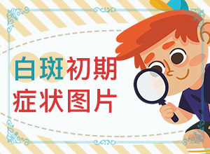 十岁孩子身上长白斑是怎么回事,发病的原因有哪些(出现白斑是怎么原因)