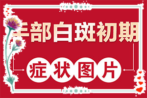 孩子后背皮肤有白班是什么情况,哪些原因诱发呢(病因有什么)