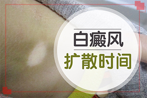 这几年我身上出现好多白斑 为什么？常见原因