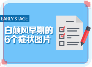 小孩子脸上白斑图片 怎么回事[为什么患上]4个宝宝身上有白斑是怎么回事