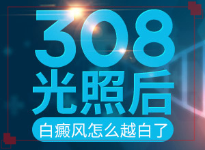 这几年我身上出现好多白斑 为什么？常见原因
