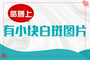 轻度白癞风图片早期能治吗-白癜风可以吗-怎样对待白癜风
