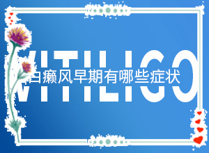 白癞风怎么可以治吗(有效诊疗方式)脸上出现白斑怎么治疗
