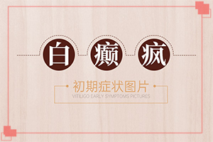 「详细」屁股长白班怎么办「跌破眼镜」皮肤白的治疗办法