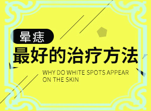 额头白如何治疗？白殿疯的治疗方法-如何才能诊疗