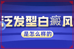 白斑病怎么治疗 能吗-如何对白癫进行治疗-为何不易治