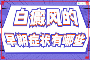 有什么方法治疗白癜风？哪些方面治疗好