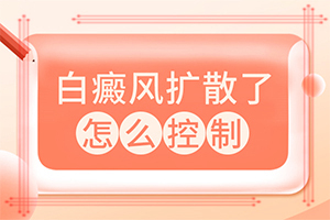 白殿疯怎么治疗好-白治疗的方法-医治白斑原则有