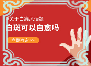 小腿上长小白斑怎么办[诊疗白斑这些是关键]白点癫风能吗