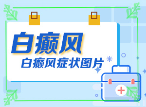「新闻播报」手部有白斑怎么治疗？白殿疯治疗方法