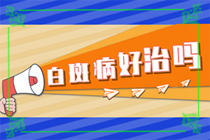 手部白斑治疗方法,诊治的方法有哪些(怎么治疗比较好)
