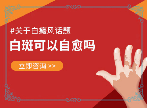 肛门白斑是怎样引起的怎么治疗[如何科学正确地]白斑可以吗