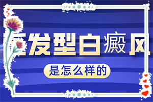 白癫治疗有哪些方法[应该遵循哪些原则]手上长白斑用什么药擦好