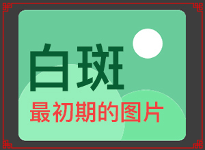 白癜风的中医治疗方法[治得效果比较快]白点癫风能根治吗