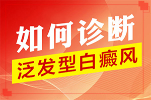 白癫治疗方法[吃什么有利于治疗]遗传白巅峰治疗法