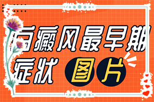 白癜风患者吃什么食物[应该注意哪些]治疗手上白斑有效的方法
