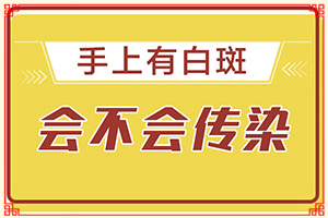 白殿风怎么冶疗？[怎么控制才好]治疗儿童癫方法