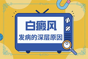 白殿风怎么冶疗？[怎么控制才好]治疗儿童癫方法