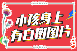 得了白点癫风怎么治疗[哪些方面治疗效果好]儿童白点癫风可以治好吗