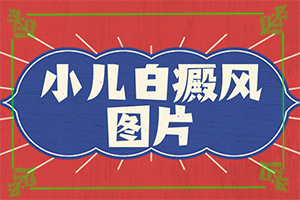 白殿病是可以治愈吗[需要注意什么]白癜风早期可以治疗吗