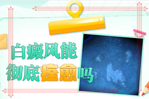 白癫疯怎么治疗好？[哪些诊疗方式可取]白癞风能彻底治好吗
