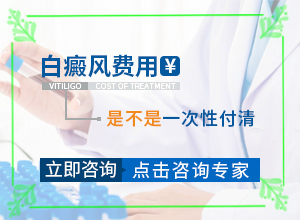白癫风治好要多少钱[白斑病防治原则]腰部的白殿风好治疗吗?