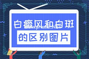 白殿风能冶好吗[多长时间有效果]治疗手上白斑有效的方法