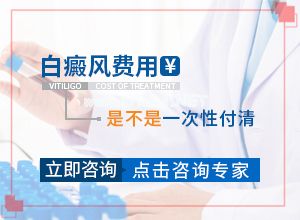 哪家医院能治疗儿童白斑[白斑病诊疗关键点]白班能治好吗