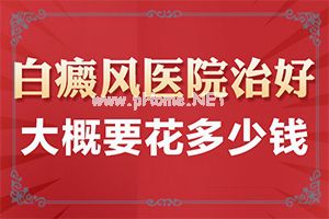 （白疯癫）治疗白颠疯费用-或可帮你一把