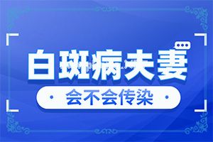 （白驳风）白点癫风会遗传下一代吗-治疗小妙招