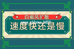 口腔白斑药物-盘点常见治疗方法[患者必读]