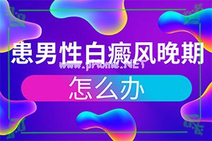 小儿白颠疯病可以治愈吗-头皮白癫风怎么治