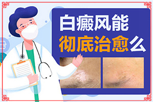 大拇指有白斑图片-身上上出现白斑小点点是怎么了-哪些症状可以判断