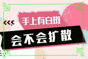 做什么检查排除白癜风(常见的类型有哪些)皮肤上一块白一块