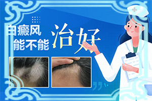 身上起白斑图片 原因(如何诊断白癜风症状)头上长白斑是什么情况