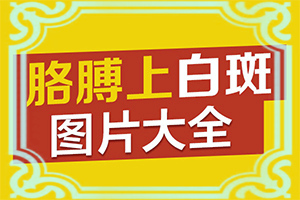 身上起白斑图片 原因(如何诊断白癜风症状)头上长白斑是什么情况